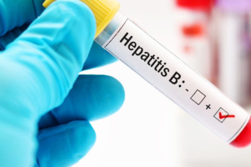 ¿Puede prevenirse la Hepatitis B? sepa cómo hacerlo para evitar complicaciones graves